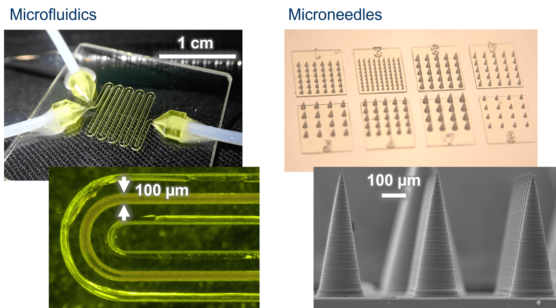 Eine Collage zeigt mikrofluidische Geräte mit gewundenen Kanälen und Schlauchaufsätzen sowie Nahaufnahmen von Mikronadel-Arrays, darunter eine rasterelektronenmikroskopische Aufnahme mit einem Maßstab von 100 μm.